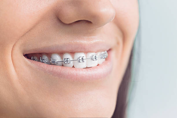 Dental Inlays and Onlays in Charlotte, TX